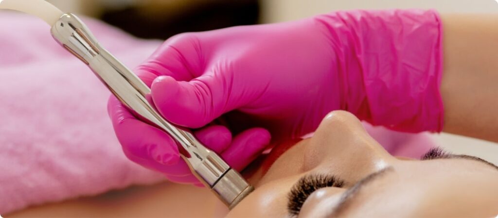 microdermabrasion