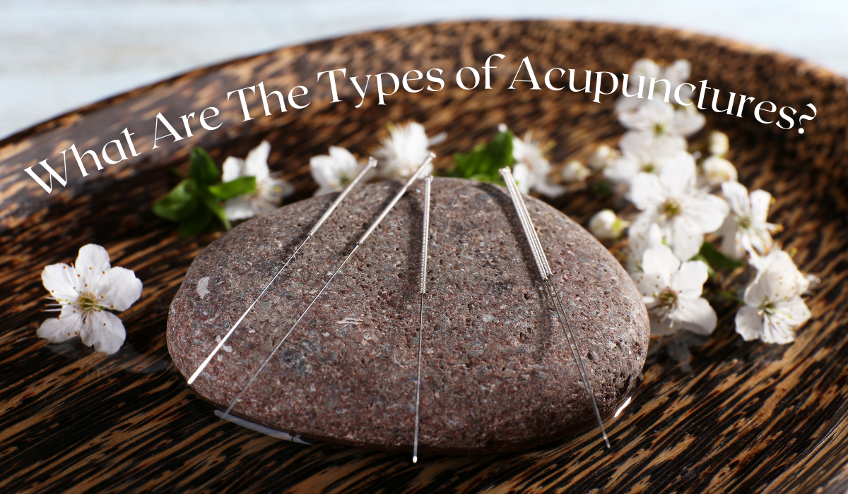 Read more about the article What Are The Types of Acupunctures?