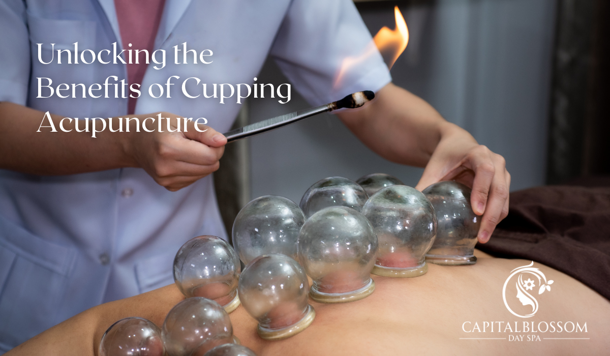 Read more about the article Unlocking the Benefits of Cupping Acupuncture