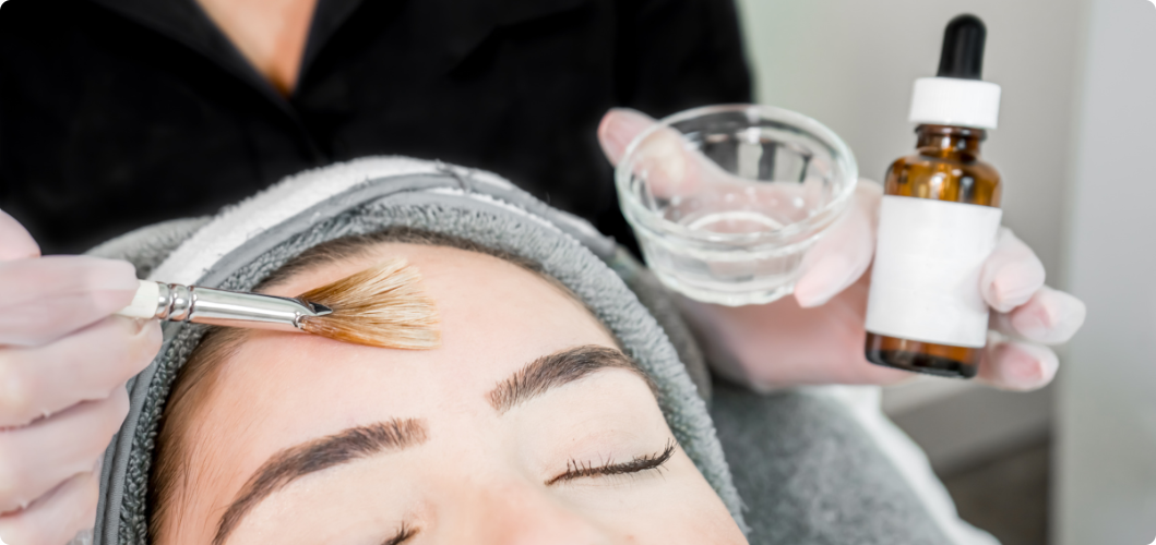 Read more about the article Chemical Peels 101: What to Expect During and After Treatment