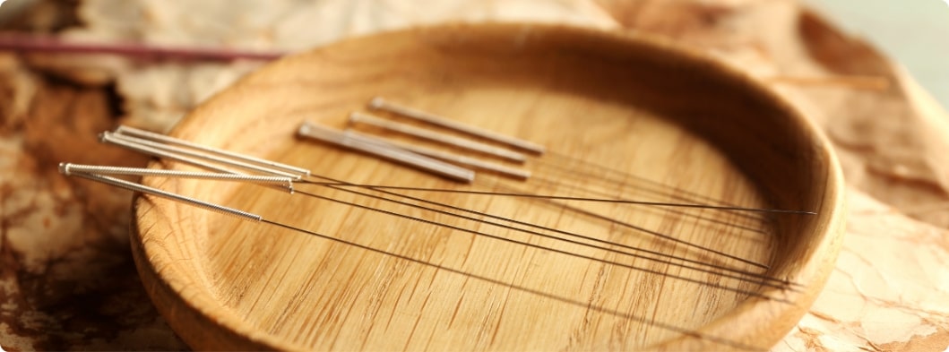 Dry Needling vs. Acupuncture | Differences in Traditional Healing ...