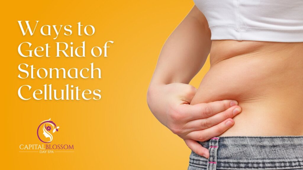 Ways to Get Rid of Stomach Cellulites