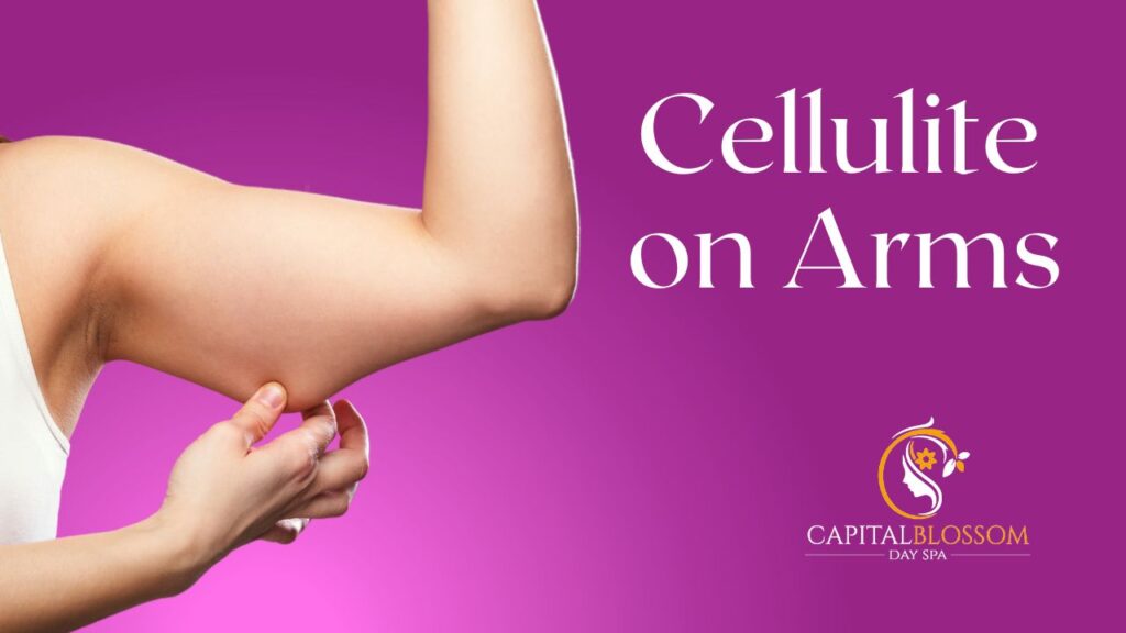 Cellulite reduction techniques for arms