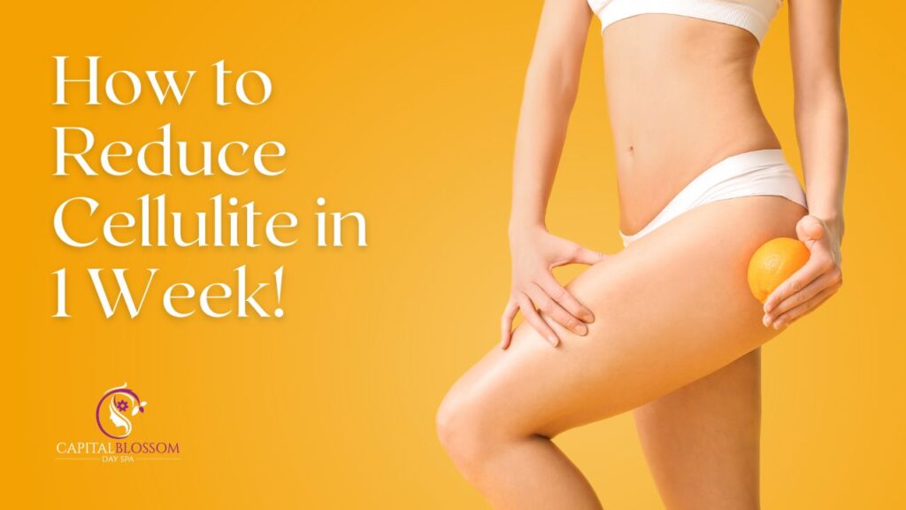 How to Reduce Cellulite in Just One Week