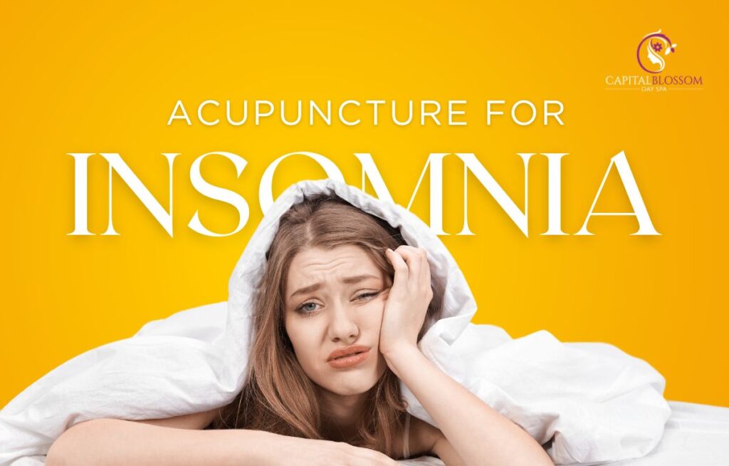 Acupuncture for Insomnia