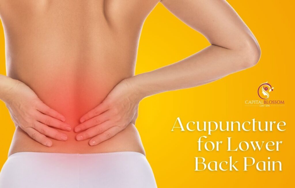 Acupuncture for lower back pain