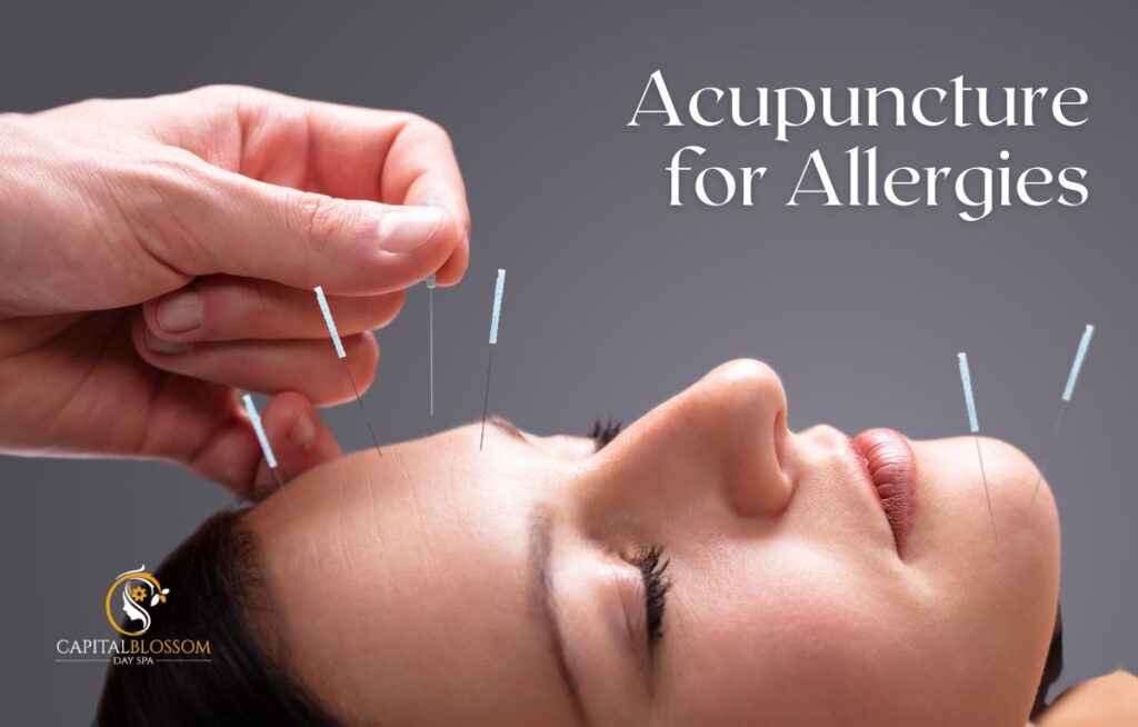 acupuncture for allergies