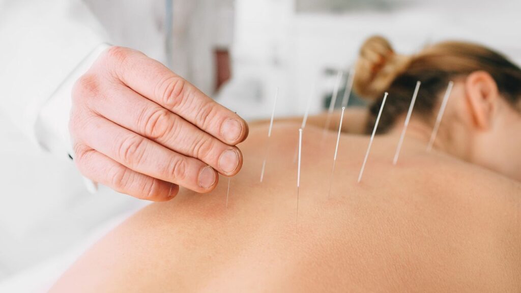 acupuncture for allergies