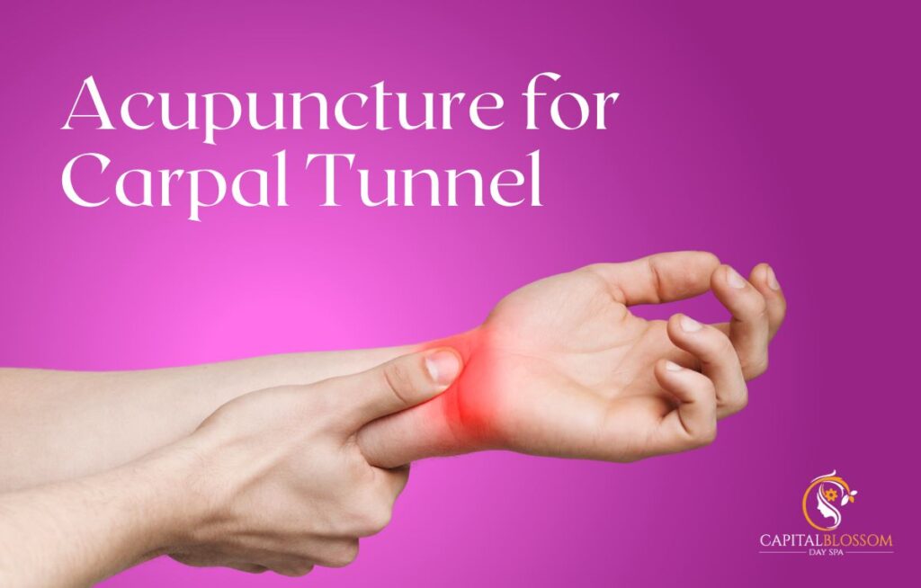 acupuncture for carpal tunnel