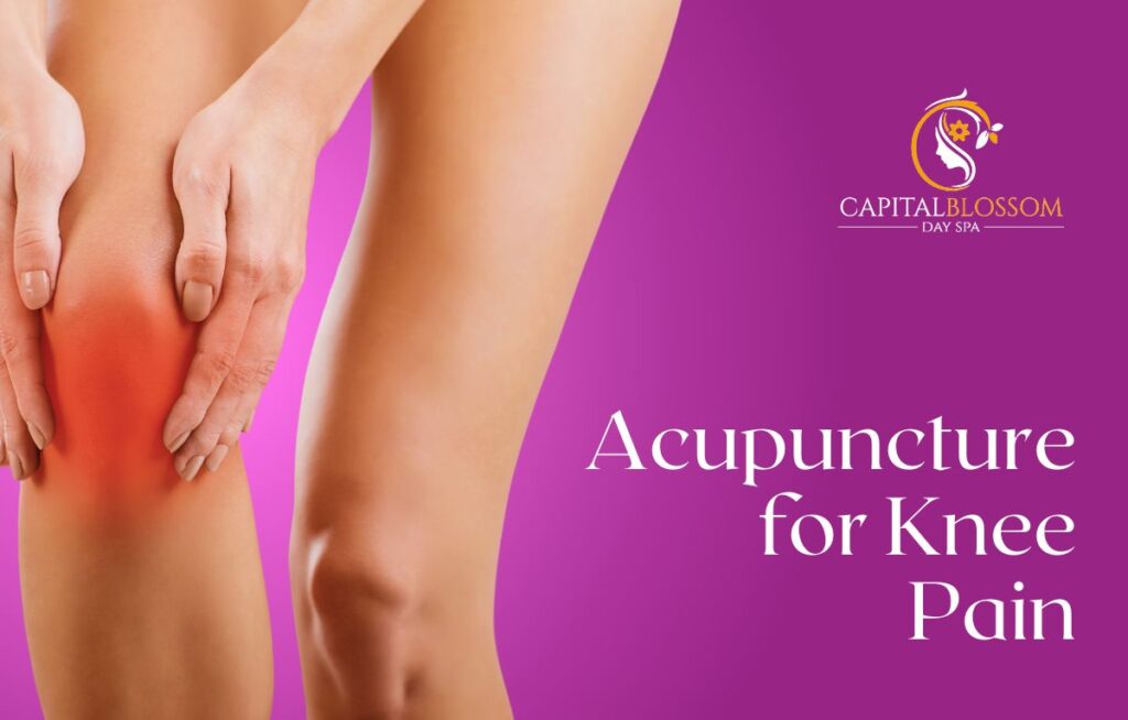 acupuncture for knee pain