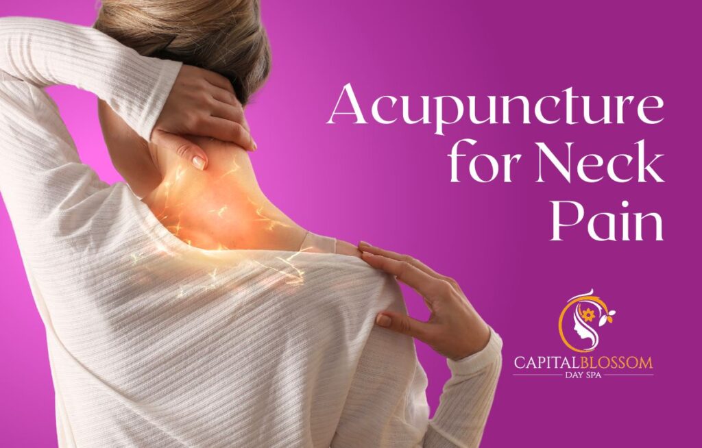 acupuncture for neck pain