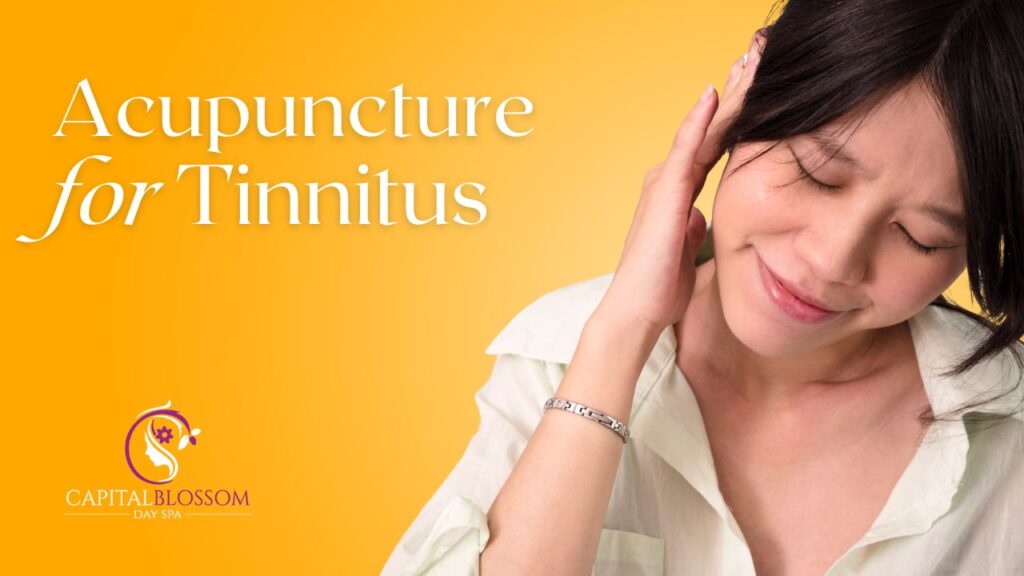 acupuncture for tinnitus