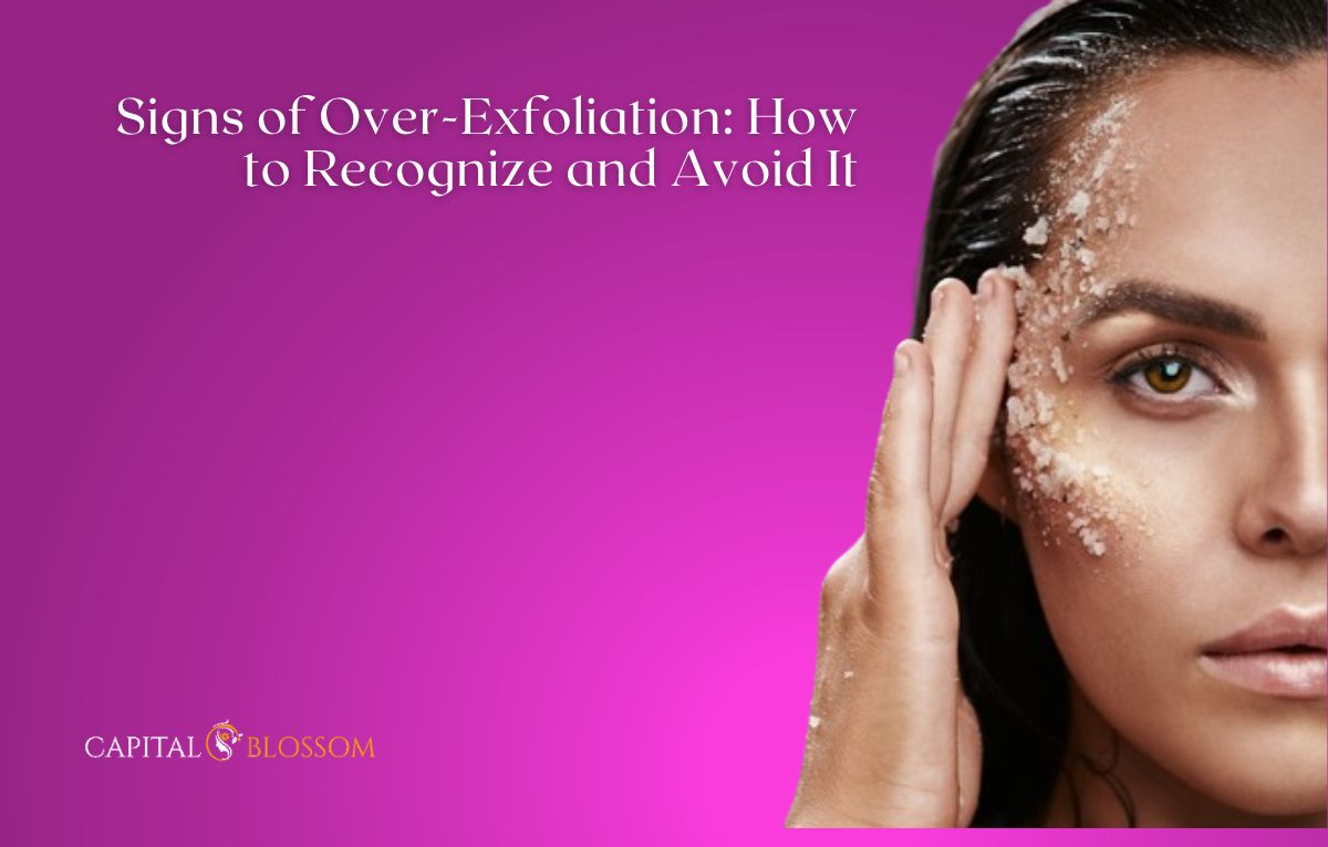 Read more about the article Signs of Over-Exfoliation: How to Recognize and Avoid It