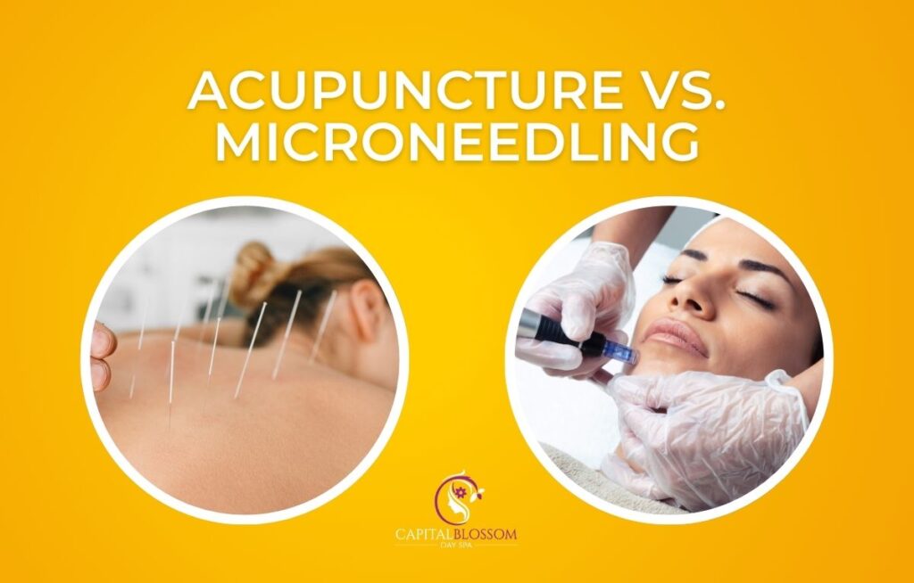 Acupuncture vs. Microneedling difference