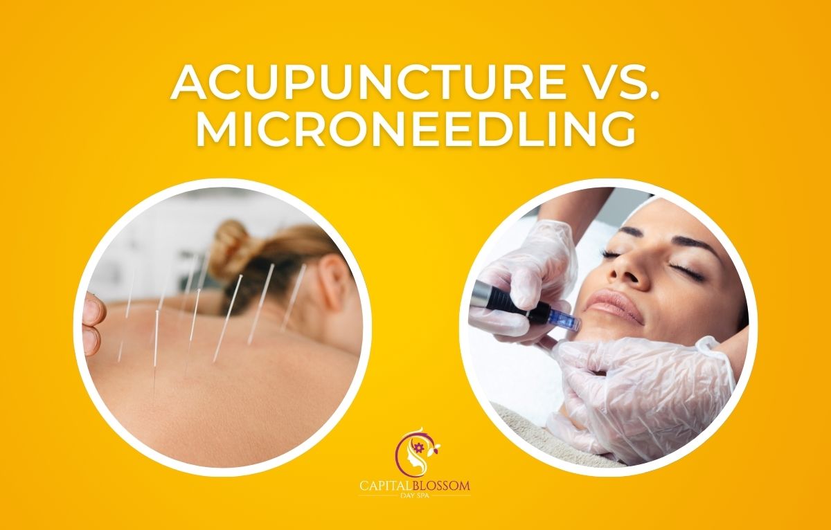 Read more about the article Acupuncture vs. Microneedling – A Comprehensive Comparison for Skin Rejuvenation