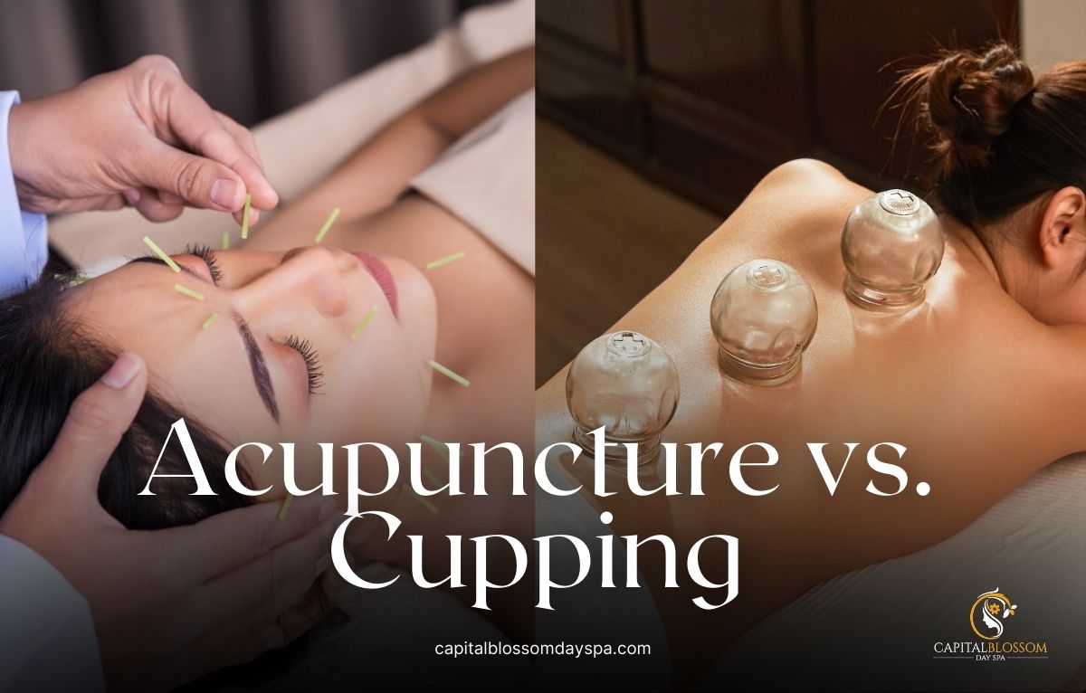 Read more about the article Acupuncture vs Cupping – Which Therapy is Right for You?