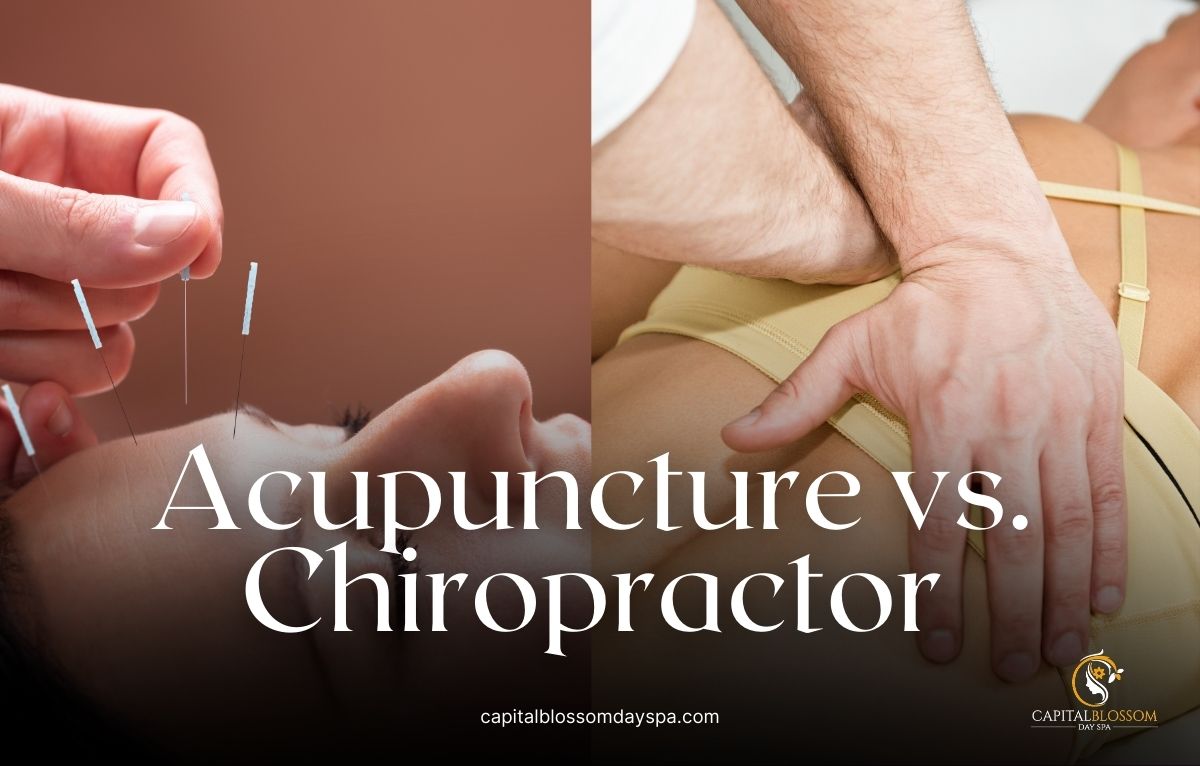 Read more about the article Acupuncture vs. Chiropractor – Learn the Differences and Benefits