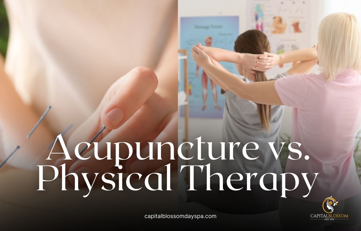 Read more about the article Acupuncture vs Physical Therapy – Which Treatment is Right for You?