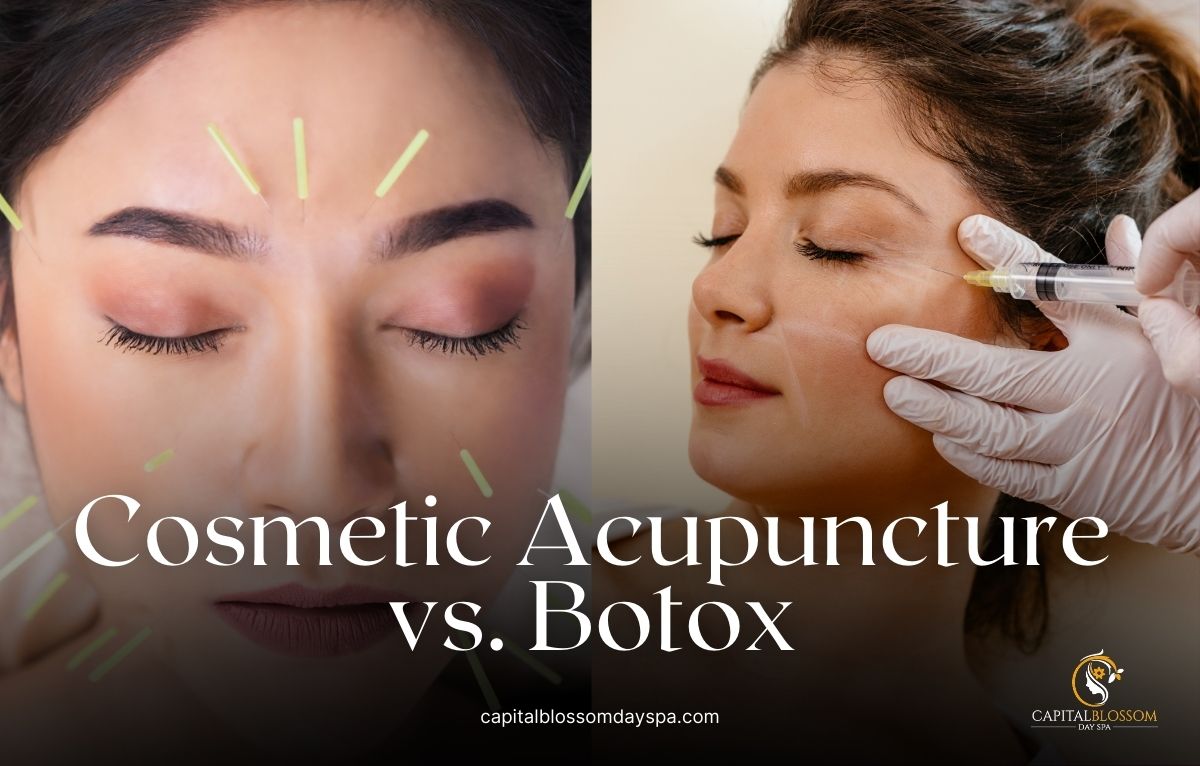 cosmetic acupuncture vs botox