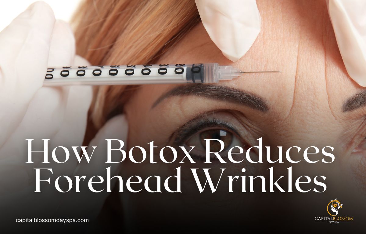 Read more about the article How Botox Reduces Forehead Wrinkles?