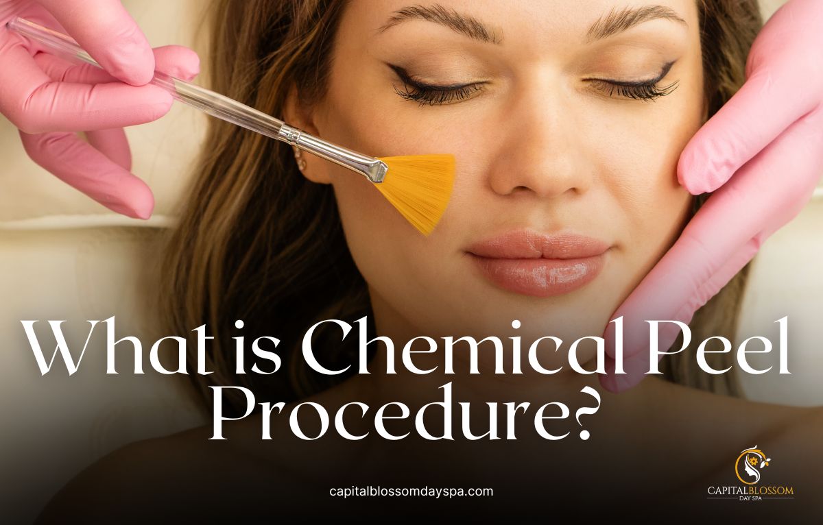 Read more about the article What is Chemical Peel Procedure?