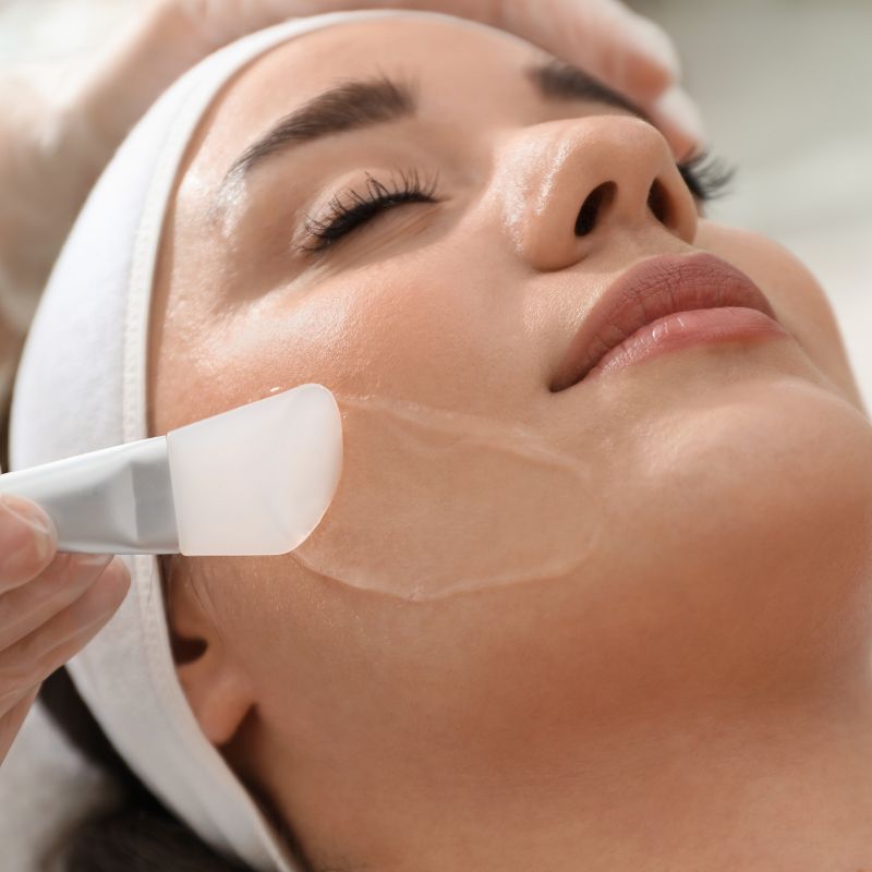 chemical peel