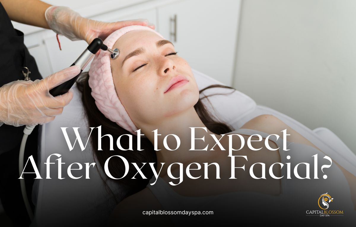 what to expect after oxygen facial