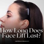 how long does face lift last