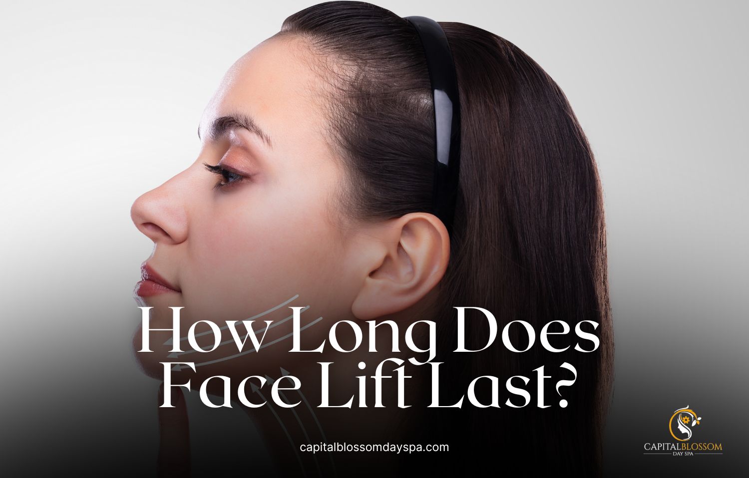 how long does face lift last