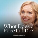 what does a face lift do