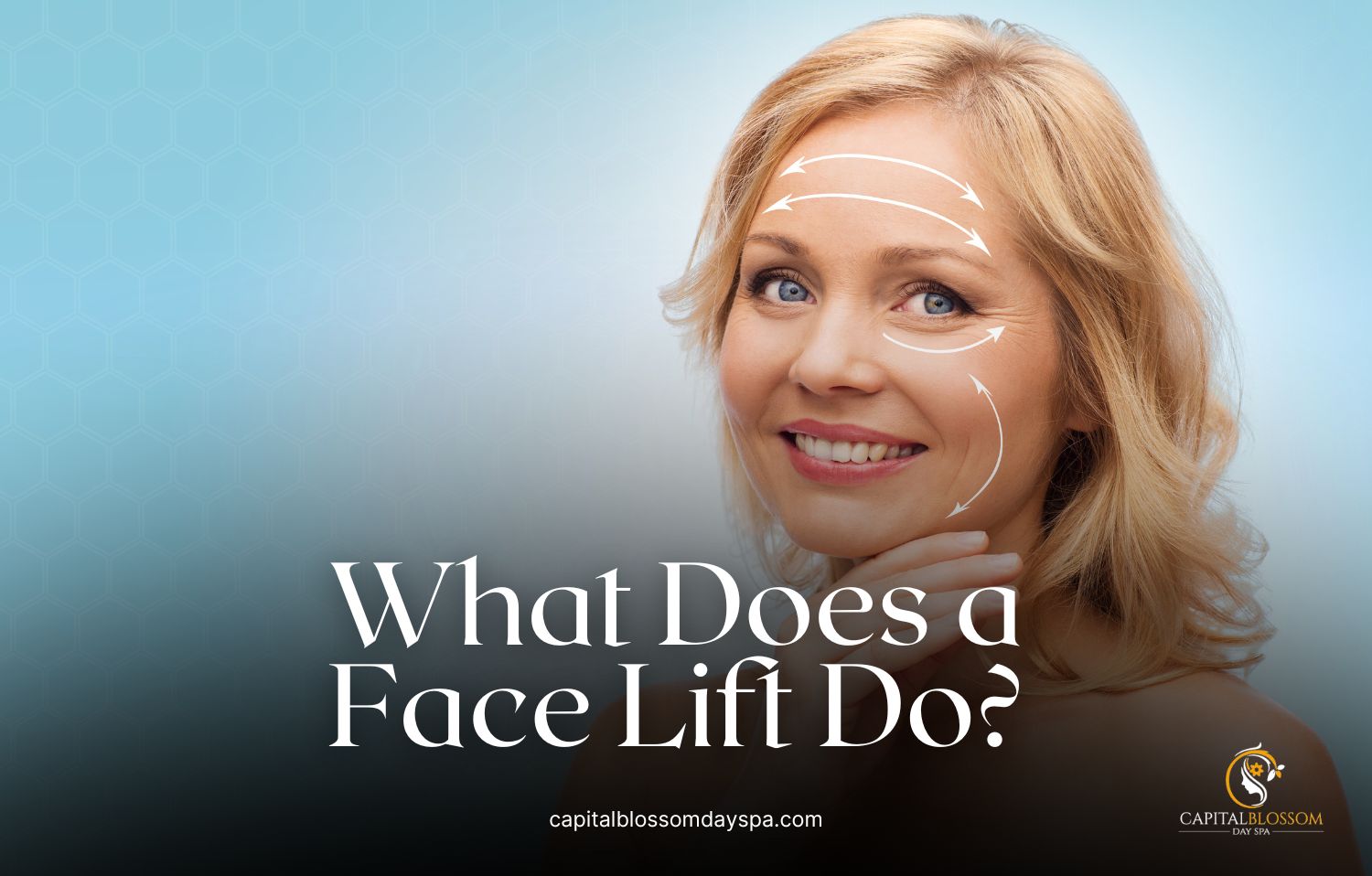 What Does a Face Lift Do?