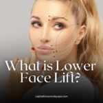 what is lower face lift