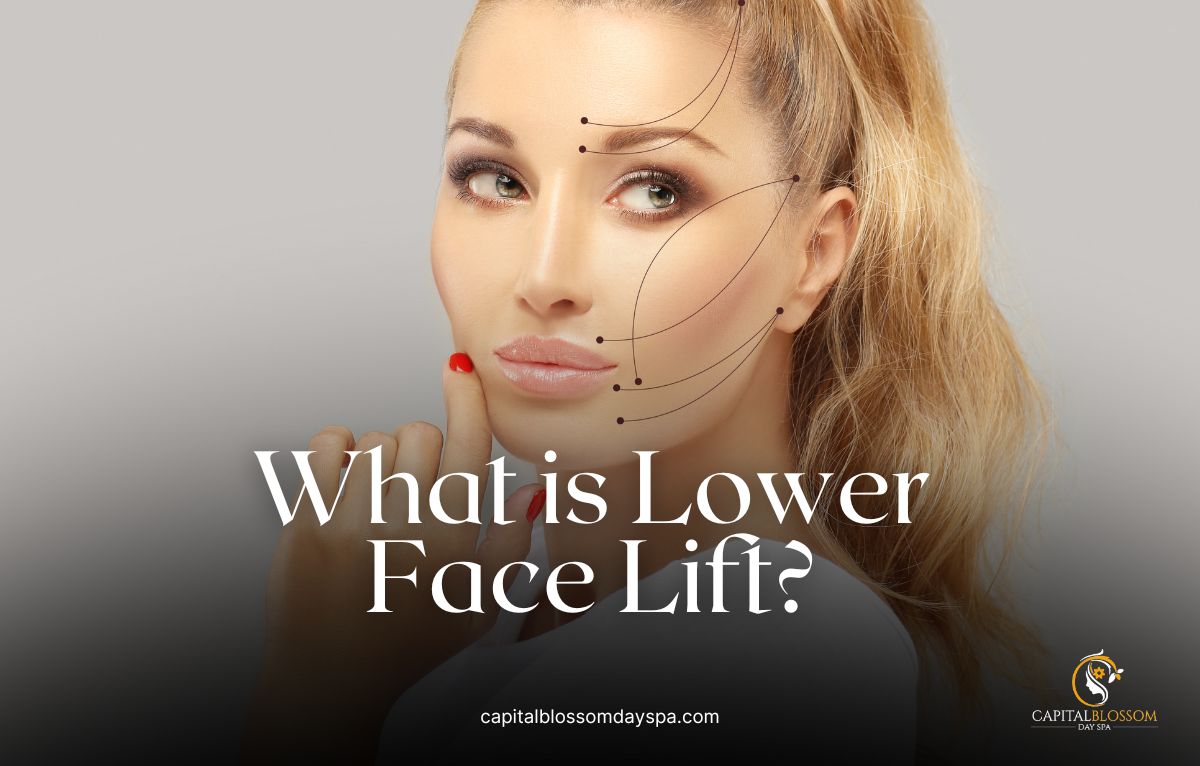 what is lower face lift