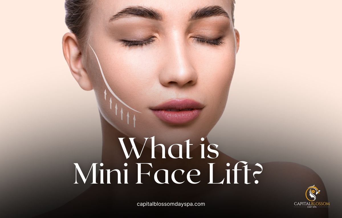 what is mini face lift