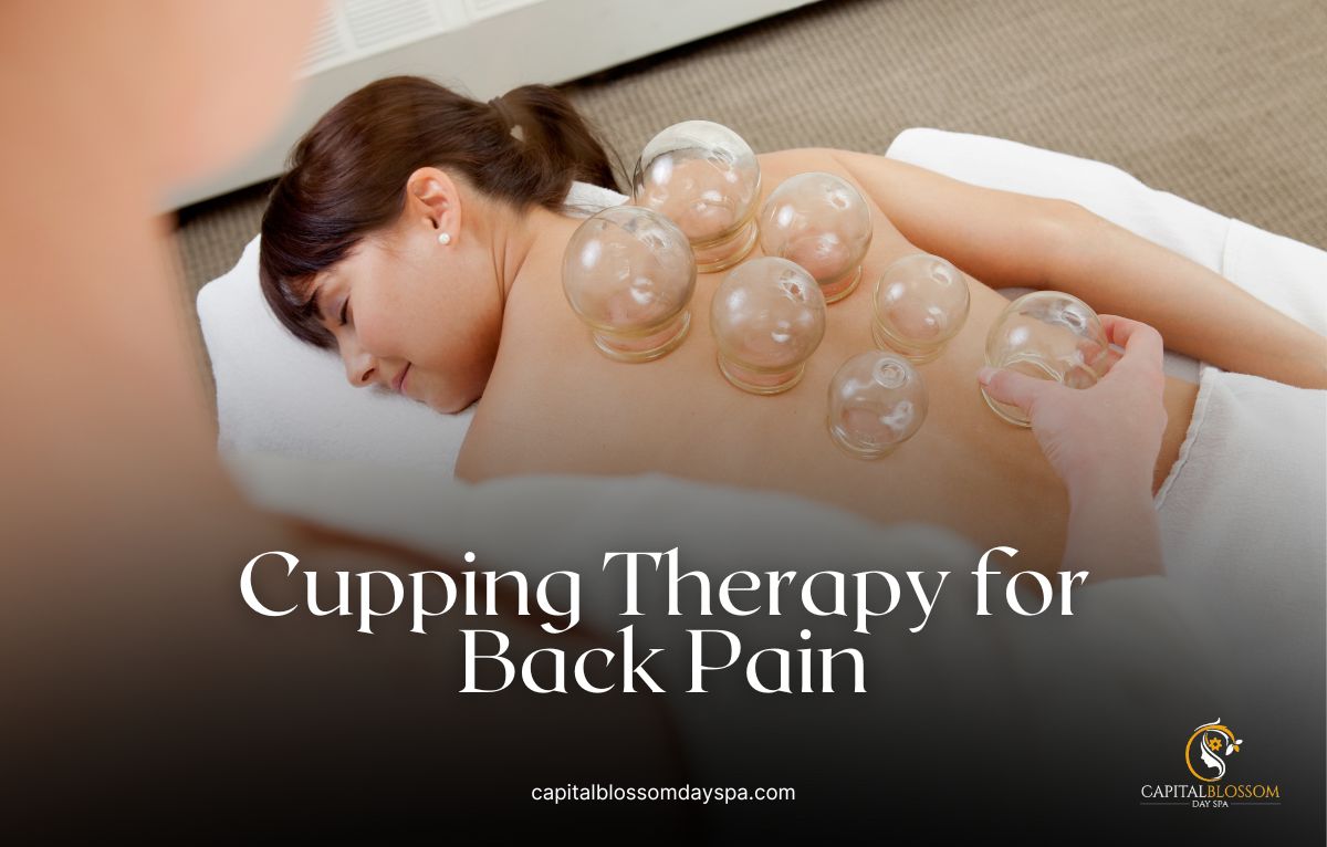 Read more about the article Benefits of Cupping Therapy for Back Pain and Muscle Tension